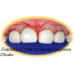 Коронки ZSmile детские циркониевые Коронки ZSmile детские циркониевые