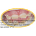 Коронки ZSmile детские циркониевые Коронки ZSmile детские циркониевые